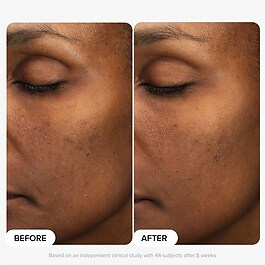 Multi-Level Exfoliation Trial Kit - Discovery Set con esfolianti AHA + BHA